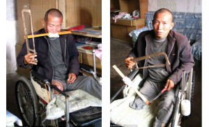 Zheng Yanliang si-a amputat singur piciorul din lipsa de bani (Inquisitr.com)