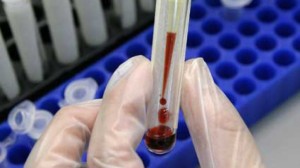 Seful laboratorul de la spitalul Targu Jiu, Adrian Udristoiu, ar fi falsificat sute de analize pentru depistarea HIV (realitatea.net)